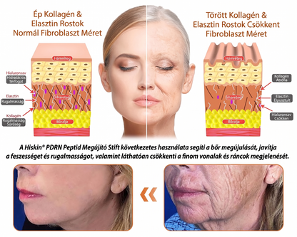 𝐇𝐢𝐬𝐤𝐢𝐧 ® 👨‍⚕️👨‍⚕️𝑷𝑫𝑹𝑵 𝑨𝒏𝒕𝒊-𝑨𝒈𝒊𝒏𝒈 & 𝑻𝒂𝒓𝒈𝒆𝒕𝒆𝒅 𝑺𝒑𝒐𝒕 𝑹𝒆𝒏𝒆𝒘𝒂𝒍 𝑺𝒕𝒊𝒄𝒌(𝑯𝒆𝒍𝒑𝒔 𝑺𝒎𝒐𝒐𝒕𝒉 𝑾𝒓𝒊𝒏𝒌𝒍𝒆𝒔, 𝑺𝒖𝒑𝒑𝒐𝒓𝒕 𝑭𝒊𝒓𝒎𝒆𝒓-𝑳𝒐𝒐𝒌𝒊𝒏𝒈 𝑺𝒌𝒊𝒏, 𝒂𝒏𝒅 𝑰𝒎𝒑𝒓𝒐𝒗𝒆 𝑻𝒉𝒆 𝑨𝒑𝒑𝒆𝒂𝒓𝒂𝒏𝒄𝒆 𝑶𝒇 𝑽𝒊𝒔𝒊𝒃𝒍𝒆 𝑺𝒑𝒐𝒕𝒔)