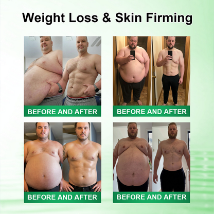 𝑶𝒇𝒇𝒊𝒄𝒊𝒂𝒍 𝑺𝒕𝒐𝒓𝒆 |🍀🍀𝐂𝐚𝐫𝐞𝐔𝐩𝐥𝐢𝐟𝐭® 𝑴𝒆𝒕𝒂𝒃𝒐𝒍𝒊𝒄 𝑵𝒂𝒏𝒐 𝑴𝒊𝒄𝒓𝒐𝒏𝒆𝒆𝒅𝒍𝒆 𝑷𝒂𝒕𝒄𝒉🇺🇸(𝐉𝐮𝐬𝐭 𝐨𝐧𝐜𝐞 𝐚 𝐝𝐚𝐲）𝘽𝙚𝙧𝙗𝙚𝙧𝙞𝙣𝙚 + 𝙈𝙤𝙧𝙞𝙣𝙜𝙖 𝙁𝙤𝙧𝙢𝙪𝙡𝙖 ✅𝐨𝐛𝐞𝐬𝐢𝐭𝐲,𝐅𝐨𝐫 𝗟𝗼𝗼𝘀𝗲 𝘀𝗸𝗶𝗻,  𝐝𝐢𝐚𝐛𝐞𝐭𝐞𝐬, 𝐬𝐥𝐞𝐞𝐩 𝐚𝐩𝐧𝐞𝐚, 𝐣𝐨𝐢𝐧𝐭 𝐢𝐬𝐬𝐮𝐞𝐬, 𝐚𝐧𝐝 𝐦𝐨𝐫𝐞💯